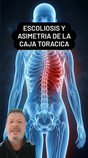 ESCOLIOSIS Y ASIMETRÍA DE LA CAJA TORÁCICA: LO QUE NADIE TE EXPLICA SOBRE TU CUERPO