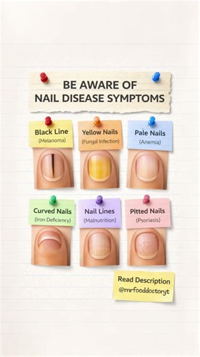 Nail Disease Warning Signs You Should Never Ignore | Nail Health Symptom Explained #healthylifestyle