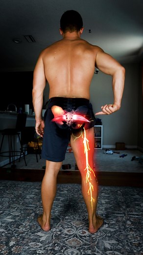 50K views · 2.3K reactions |  How to Test Sciatica VS Piriformis...
