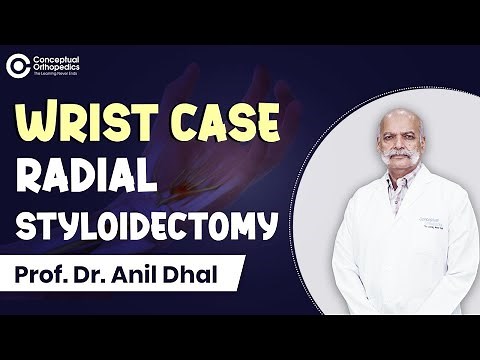 Wrist Case Radial Styloidectomy By Prof. Dr. Anil Dhal