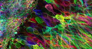 Getting High-resolution Images from Conventional Microscopes | Microbiology