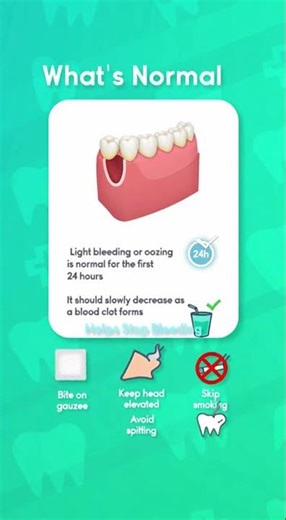 🦷 Still Bleeding After Wisdom Tooth Removal — Is It Normal?