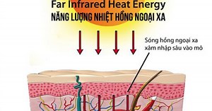 Tia hồng ngoại xa hỗ trợ điều trị các bệnh cơ xương khớp