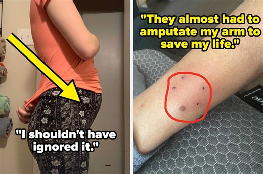 People who ignored their health problems are sharing what they wish they paid attention to sooner