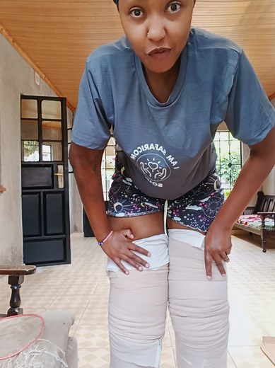 Compression Bandages for Lipedema: Strength, Healing, Support