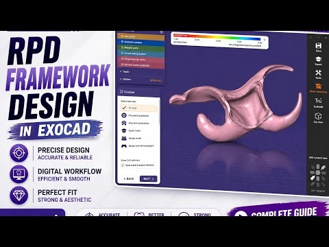 Don't Miss These Steps | Precision RPD Framework Design in Exocad