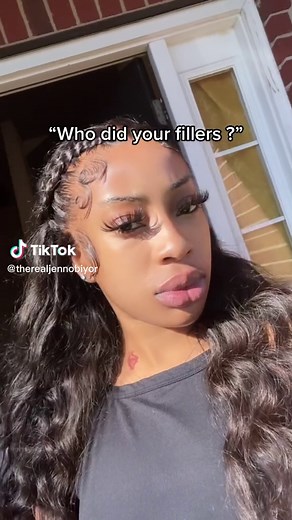 Understanding Lip Augmentation: Why Lips Get Bigger with Age