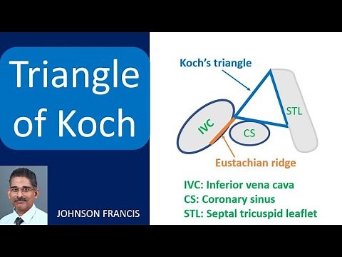 Triangle of Koch - Importance in Catheter Ablation of SVT