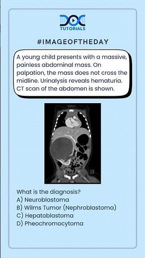 What is the diagnosis?