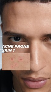 209 reactions | Clear skin is clean skin with Garnier Pure Active. Get your 3in1 wash now | Garnier | Facebook