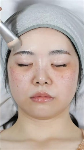 Unbelievable Acne Coverage Hack! 😱 Flawless Skin in Seconds | Makeup Transformation