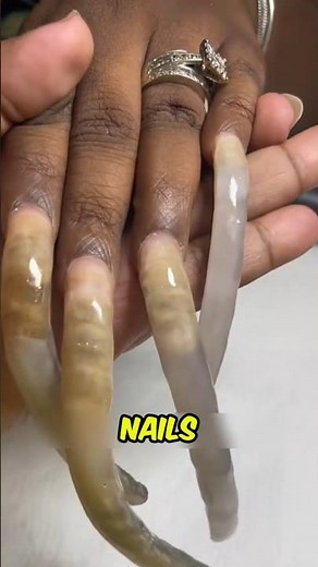 What Happens If You NEVER Cut Your Fingernails?