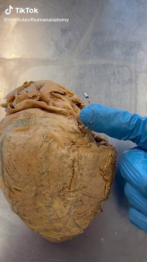 Understanding the Pacemaker Technology