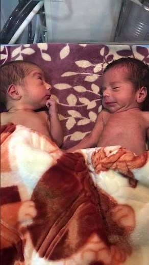 Cute Little Baby Twins 😍💖 | Double Cuteness & Sweet Moments 😽 #BabyTwins #CuteBaby