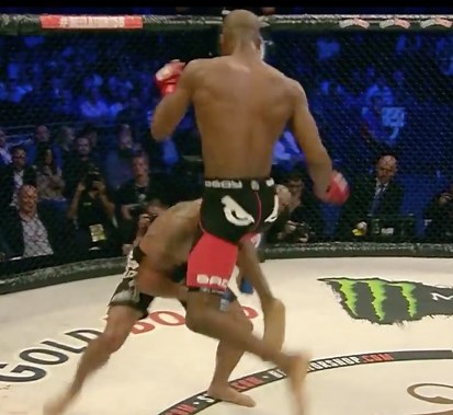 Shocking Photos of Cyborg Santos’ Fractured Skull From Flying Knee - BlackSportsOnline