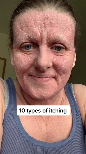 Understanding the 10 Types of Itching and Scratching