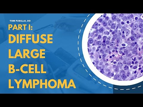 Diffuse Large B-Cell Lymphoma | Part I: Epidemiology, Genetics, Subtypes, Workup, and Pathology