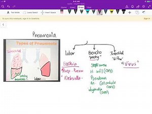 Types of Pneumonia : Lobar , Bronchopneumonia , Interstitial / Diffuse