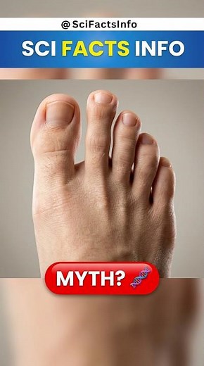 The Truth About Morton's Toe | It’s Not What You Think #history #facts