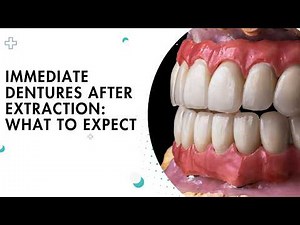 Immediate Dentures After Extraction: What to Expect | Shrouf Dental House
