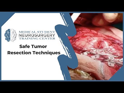 Safe Tumor Resection Techniques