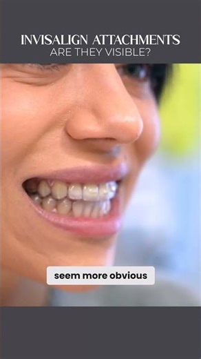 Invisalign attachments are they visible?
