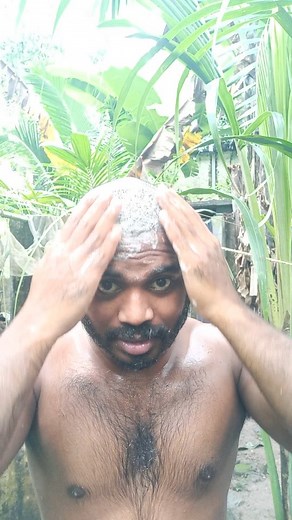 Hair transplant after how to hair washing. Explain T.K kabali | Kabali