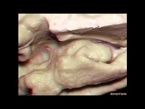 Navigating the Ventricles (3D)