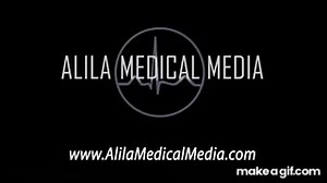 Cancer, How Cancer Starts, How Cancer Spreads, Where and Why, Animation. on Make a GIF