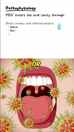 How Herpes Infects The Oral Cavity | Herpes Simplex Virus