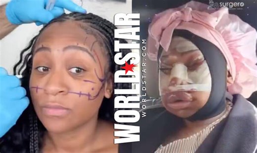 Woman Shows Off Her Before-And-After Plastic Surgery Transformation!