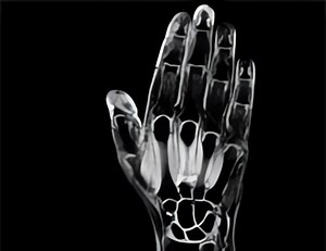 IRM de la main - IRM des Sources