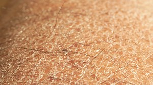 Closeup view of dry human skin .
