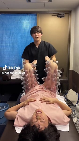 上殿神経痛 神経痛に対して、カッピングで骨盤周りの筋緊張を除去し、症状を緩和させました！！ #整体 #鍼灸 #カッピング #ストレッチ #オイルマッサージ #マッサージ #腰痛 #神経痛 #坐骨神経痛
