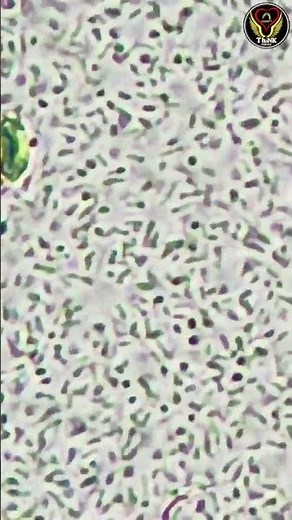 Microbes 🦠moving in Urine Sample under microscope 🤯🔬 |Motility| Microbiology | Biology |ThiNK VISION