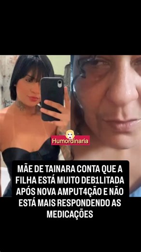 Humordinaria | Fofoca on Instagram: "🚨 VAMOS CONTINUAR COM AS ORAÇÕES 🙏 Lúcia Aparecida, mãe de Tainara Souza Santos, informou através de um vídeo publicado nesta terça-feira (23), que a filha passou por uma nova c*rur*ia na segunda-feira (22) e que está bastante deb*litada e com dificuldades para responder as medicações. Vamos todos continuar orando muito pela recuperação física e ps*col*gica da Tay 🙏 (Reprodução: Lúcia Aparecida) #noticias"