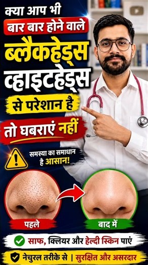 चेहरे के Blackheads, Whiteheads, Open Pores व दाग धब्बों से 100% छुटकारा पाएं | #blackheads #shorts