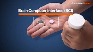 12K views · 63 reactions | ABC News' Kaylee Hartung has an in-depth look at how Brain Computer Interface (BCI) could help those suffering from paralysis or brain injuries by turning their thoughts into actions, and the potential pitfalls of this technology. https://abcn.ws/3kndCGo | ABC News Live | Facebook