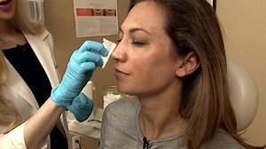 How to overcome melasma, aka 'pregnancy mask'