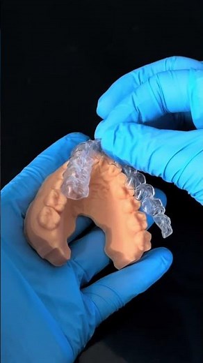 Direct 3D printed clear aligner demo — high transparency, balanced flexibility, and a precise fit.
