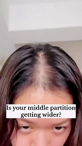 66K views · 813 reactions | Have you noticed your middle partition...