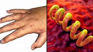 Doctors explain why deadly Victorian diseases are spreading across the UK