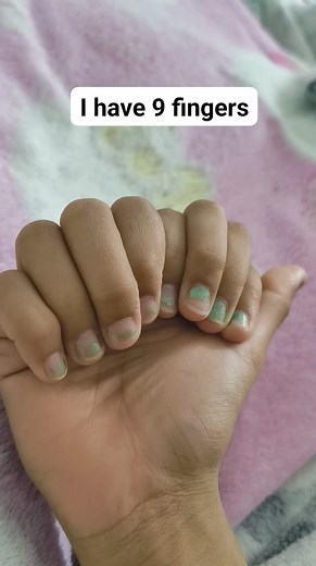 I have 9 fingers #viralreelsfb #fingerchallenge #fingerscrossed #fingertrick | Fashion Fitness Tips