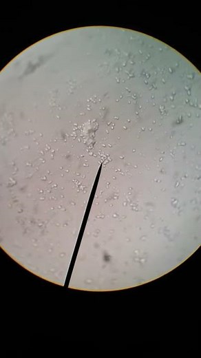Microbiology Lab - hanging drop motility test