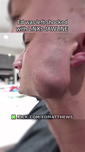 LiNX's Jawline Shocked Ed Matthews