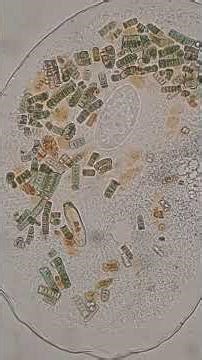amoeba Thecamoeba, nucleus and chromatin