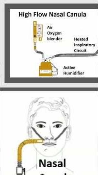 Oxygen Therapy: Venturi Mask & High-Flow Nasal Cannula #shorts