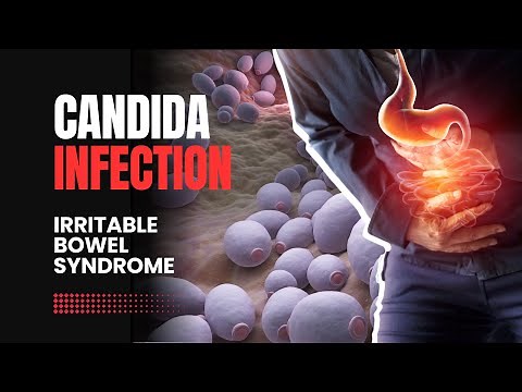 What is Candida Gut Infection? | Explained
