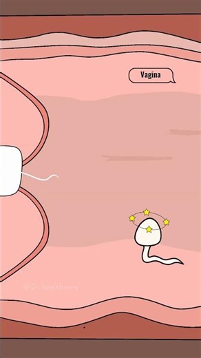 How Does the Copper IUD Actually Work? #shorts