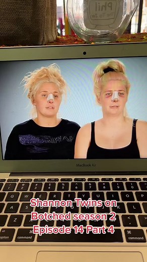 To be honest I lost count and im praying this is actually part four of the shannon twin on botched back in 2015! Classic television for sure! #shannontwins #theshannontwins #playboy #botchedplasticsurgery #botchedsurgery #plasticsurgery #celebritytiktok #celebrityplasticsurgery #playboyplaymate #playboy #playboybunny #twins #twinsisters